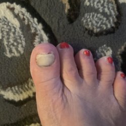 Phanny's Nail & Spa - Major infection!