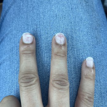 Blue Bliss Nails Spa - Closer pic of damage - Nail Salons Near Me - Chandler, Arizona