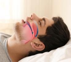 Center for Sleep and Nasal Sinus Disorders - sleep specialist in Goshen, IN