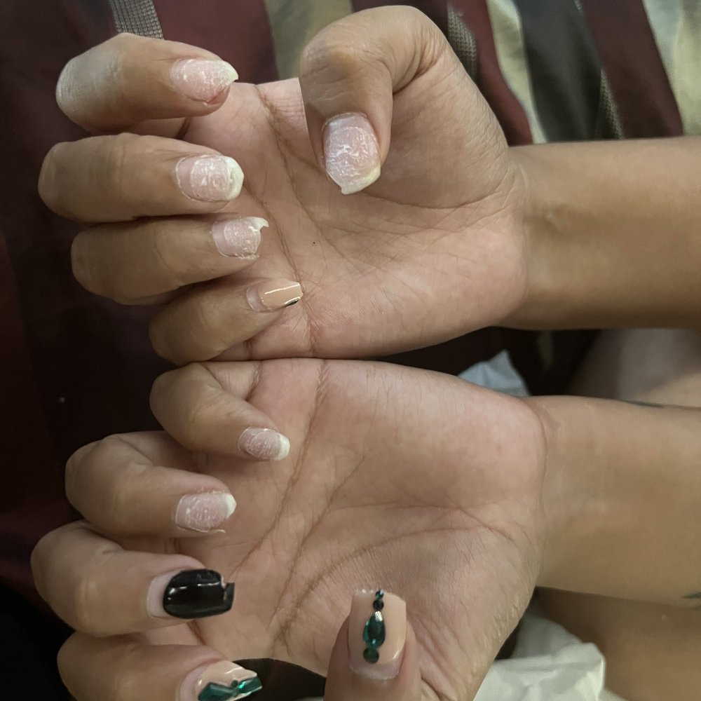 I have two nails bleeding my right index and left ring finger I have two nails bleeding my right index and left ring finger