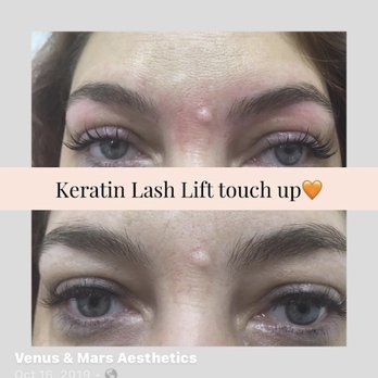 Venus & Mars Aesthetics - Upgrade your natural beauty with a keratin lash lift. - Skin Care Near Me - Houston Tx, Texas Venus & Mars Aesthetics - Upgrade your natural beauty with a keratin lash lift. - Skin Care Near Me - Houston Tx, Texas