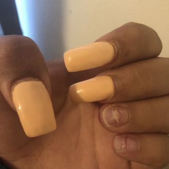 New Generation Nails - As you can see the nails are cracked in the center horizontally from her snapping them off. - Nail Salons Near Me - Menlo Park, California