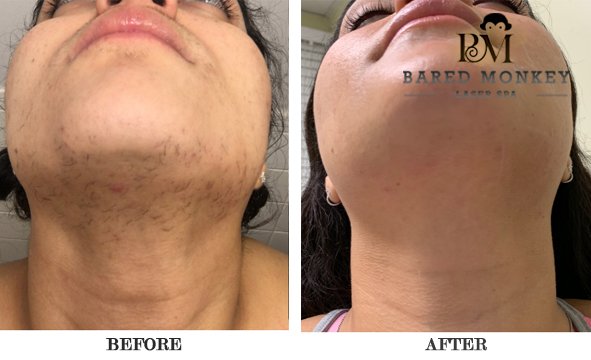 Bared Monkey Laser Spa by null