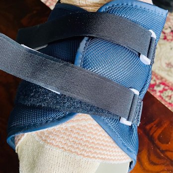 21 Reade Place - Post-op walking shoe. Kidner procedure - Podiatrists Near Me - Poughkeepsie, New York 21 Reade Place - Post-op walking shoe. Kidner procedure - Podiatrists Near Me - Poughkeepsie, New York