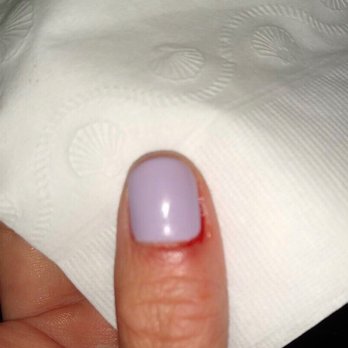 Soleil Tan & Spa - One of my finger that get a cut and bleeding - Skin Care Near Me - Boston, Massachusetts Soleil Tan & Spa - One of my finger that get a cut and bleeding - Skin Care Near Me - Boston, Massachusetts