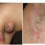 Photo of Tesoro Laser Spa