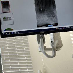 Fife and Steffen Endodontics - The X-ray of my tooth.