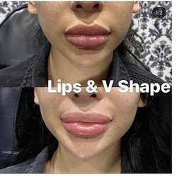 Vive Medical Spa 33 Photos 42 Reviews Cosmetic Surgeons Diego Rivera 2351 Tijuana Baja California Mexico Phone Number Yelp