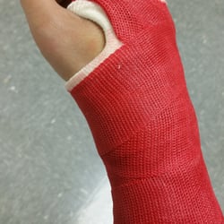 Kerlan-Jobe Orthopedic Clinic - My Hell Boy cast for my Boxer fracture