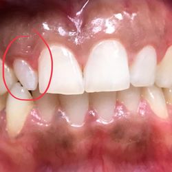 Foothill Family Dental - Before