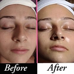 Touch of Beauty by Monica - Before and after facial.  Check out the after glow!