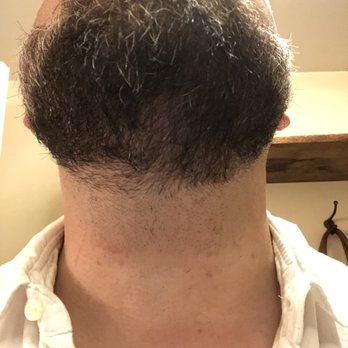 Mentors Barber Shop & Style - Red marks left from clippers and clearly not well done with the straight-razor. And look at all the stranglers!  What is this guy thinking? - Barbers Near Me - Pasadena, California