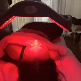Light to remove sun damage/ hyperpigmentation Light to remove sun damage/ hyperpigmentation