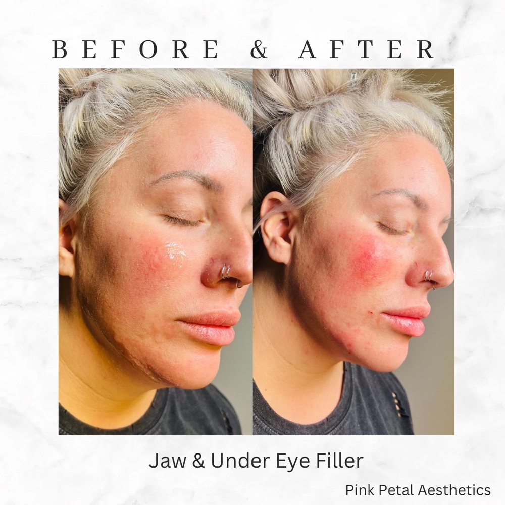 PINK PETAL AESTHETICS Request an Appointment 15 Photos Farragut