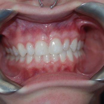 Smileodontics - Orthodontists Near Me - Mason, Ohio Smileodontics - Orthodontists Near Me - Mason, Ohio