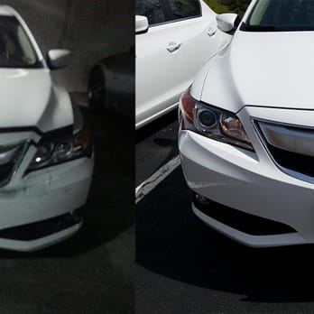 K & W Auto Body - The Before / After comparison of my Acura once K&W laid its talented hands on it... *hugs car and apologizes* - Body Shops Near Me - Woodbridge, Virginia K & W Auto Body - The Before / After comparison of my Acura once K&W laid its talented hands on it... *hugs car and apologizes* - Body Shops Near Me - Woodbridge, Virginia