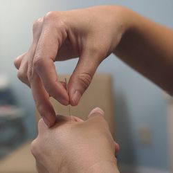 Neuro Point Acupuncture