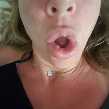Couture Med Spa - Lumps and uneveness. This should never happen. - Medical Spas Near Me - Winter Park, Florida