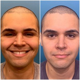 Before and After Before and After