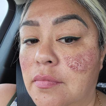 Mybrows Studio & Academy - This was me like 5 days after the procedure - Permanent Makeup Near Me - Rancho Cucamonga, California Mybrows Studio & Academy - This was me like 5 days after the procedure - Permanent Makeup Near Me - Rancho Cucamonga, California