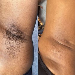 MEG & Co - Underarm Wax