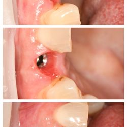 Bright Dental