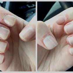 Natural Nails - This is what my nails look like after getting an $18 manicure here just 4 DAYS ago. My cuticles are so sore and my left thumb is infected.