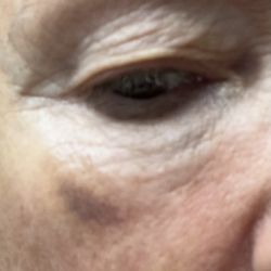 New Radiance Cosmetic Centers - Palm Beach