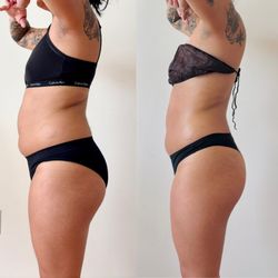 Bare Fruit Body Lab - 3 sessions of Lipo cavitation.