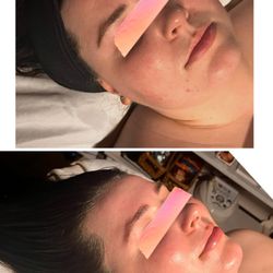 Tiana Marie Esthetics - Sometimes our skin needs a little pick me up- our Hydrating Enzyme Facial is a perfect go to for any skin type, even sensitive!