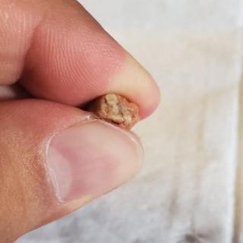 Pho Consomme - Pinching the living hell out of it to show you that its a literal rock I bit into. - Vietnamese Near Me - Gardena, California