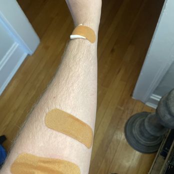Physicians Immediate Care - Band Aids from blood draw - Urgent Care Near Me - Chicago, Illinois