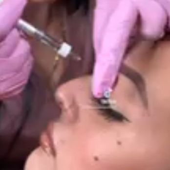 SKYN MD - Liquid rhinoplasty - Medical Spas Near Me - Ontario, California SKYN MD - Liquid rhinoplasty - Medical Spas Near Me - Ontario, California