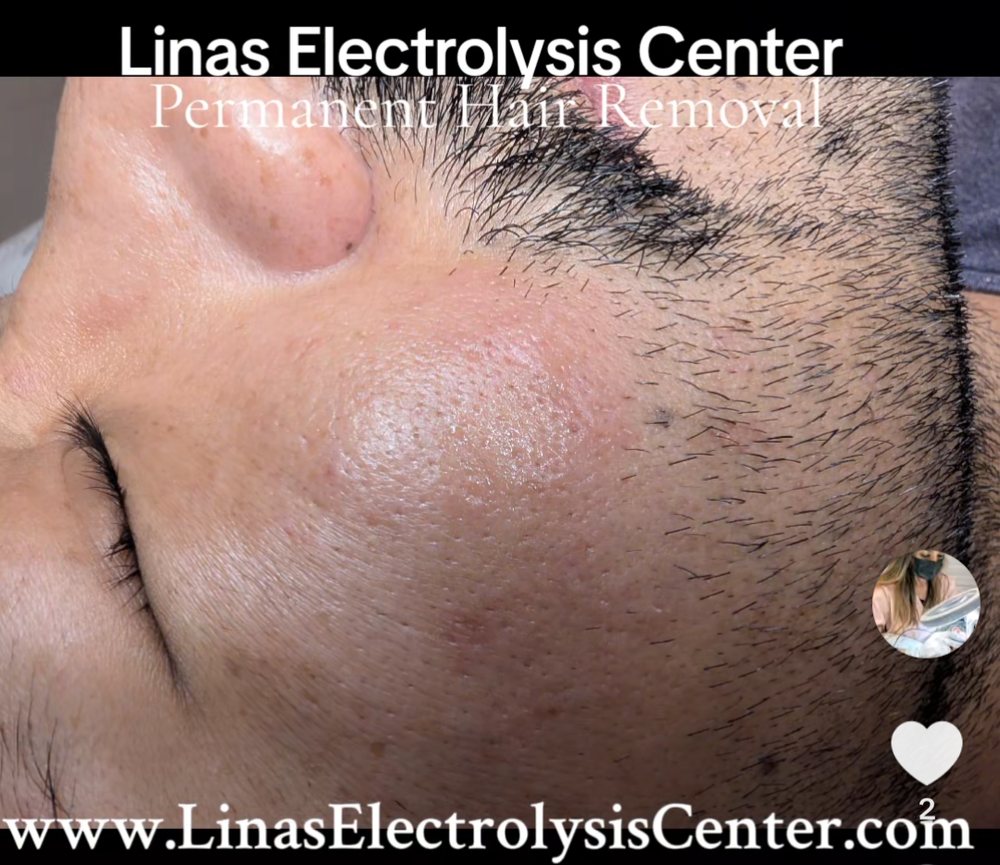 Lina's Electrolysis Center Logo