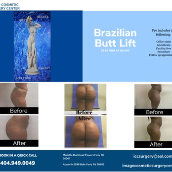 Image Cosmetic Surgery Center - Cosmetic Surgeons Near Me - Acworth, Georgia Image Cosmetic Surgery Center - Cosmetic Surgeons Near Me - Acworth, Georgia