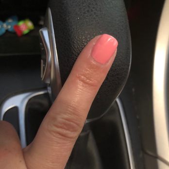 Lavish Nails & Spa - What are these craters on my nail? - Nail Salons Near Me - Orlando, Florida Lavish Nails & Spa - What are these craters on my nail? - Nail Salons Near Me - Orlando, Florida
