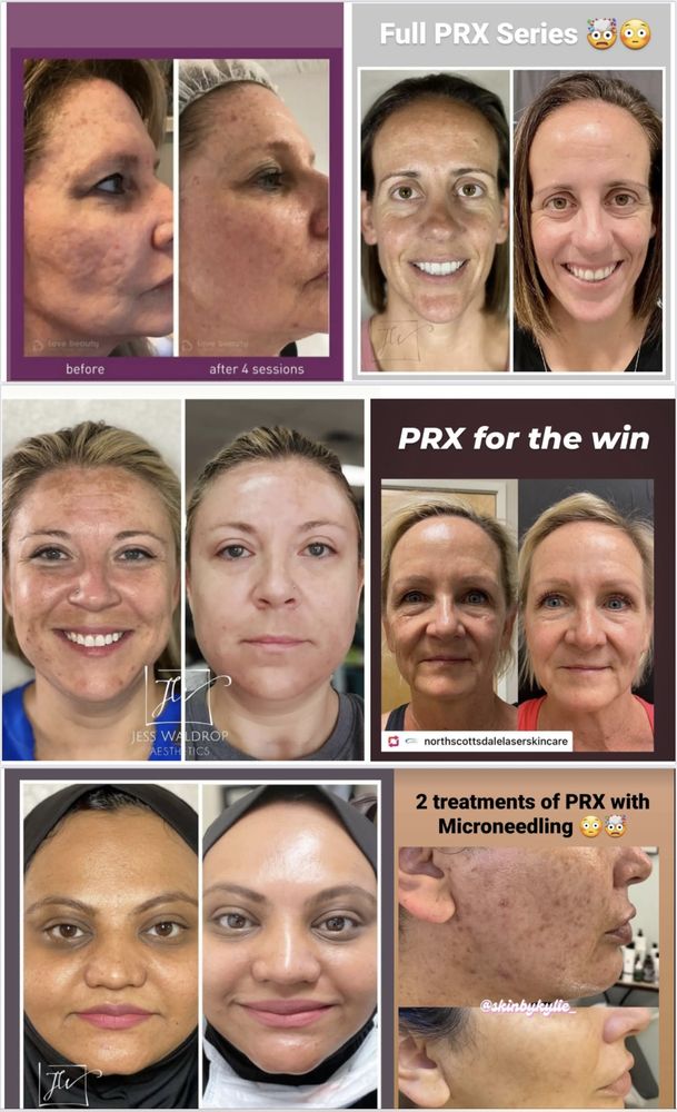 La Belle Med Spa Logo