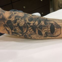 INK B GONE Tattoo Removal Denver - George BEFORE forearm