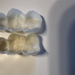 Removable Veneers USA