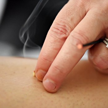 Blue Tortoise Acupuncture - Moxibustion Treatment - Acupuncture Near Me - Markham, Ontario Blue Tortoise Acupuncture - Moxibustion Treatment - Acupuncture Near Me - Markham, Ontario