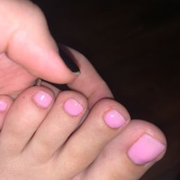 Toenail cut way too short and is now irritated