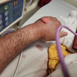Daniel D Lee, MD - A blowout of IV