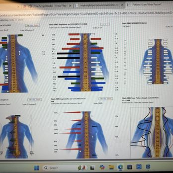 Torrey Hills Chiropractic - Evaluación de los nervios y donde tengo más tensión - Chiropractors Near Me - San Diego, California Torrey Hills Chiropractic - Evaluación de los nervios y donde tengo más tensión - Chiropractors Near Me - San Diego, California