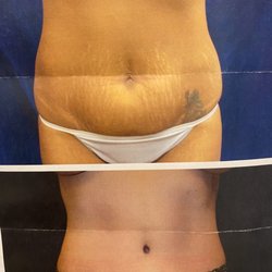Becker Plastic Surgery