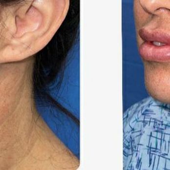Thomas W. Barnes, MD - Cosmetic Surgeons Near Me - Newport Beach, California