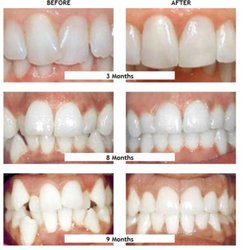 Mercedes R Del Valle, DDS - Integrated Family Dentistry - They have Fastbraces available. Straight teeth in a short time and it's affordable.