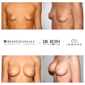 West Ave Plastic Surgery - RSVP today for BREASTS & BRUNCH! Consultations & brunch with Dr Roth from 11a to 130p on Thursday, October 11th! Implants 50% off! - Cosmetic Surgeons Near Me - Houston, Texas West Ave Plastic Surgery - RSVP today for BREASTS & BRUNCH! Consultations & brunch with Dr Roth from 11a to 130p on Thursday, October 11th! Implants 50% off! - Cosmetic Surgeons Near Me - Houston, Texas