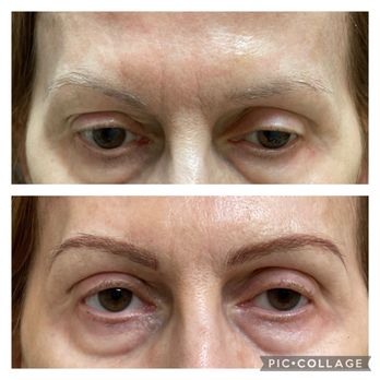 About Face - Hairstroke brows immediately after - Medical Spas Near Me - Chattanooga, Tennessee About Face - Hairstroke brows immediately after - Medical Spas Near Me - Chattanooga, Tennessee