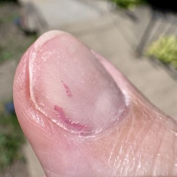 Nailworks - A cruel farewell: rough, damaged, and still covered in leftover gel. - Nail Salons Near Me - Pittsburgh, Pennsylvania Nailworks - A cruel farewell: rough, damaged, and still covered in leftover gel. - Nail Salons Near Me - Pittsburgh, Pennsylvania
