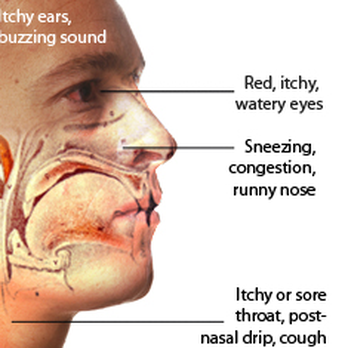 Matthew Finerman, MD - Ear Nose & Throat Near Me